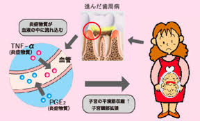 出産回数と歯の健康について【大阪市都島区内の歯医者|アスヒカル歯科】