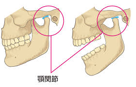 顎関節症のセルフケアPart2【大阪市都島区内の歯医者|アスヒカル歯科】
