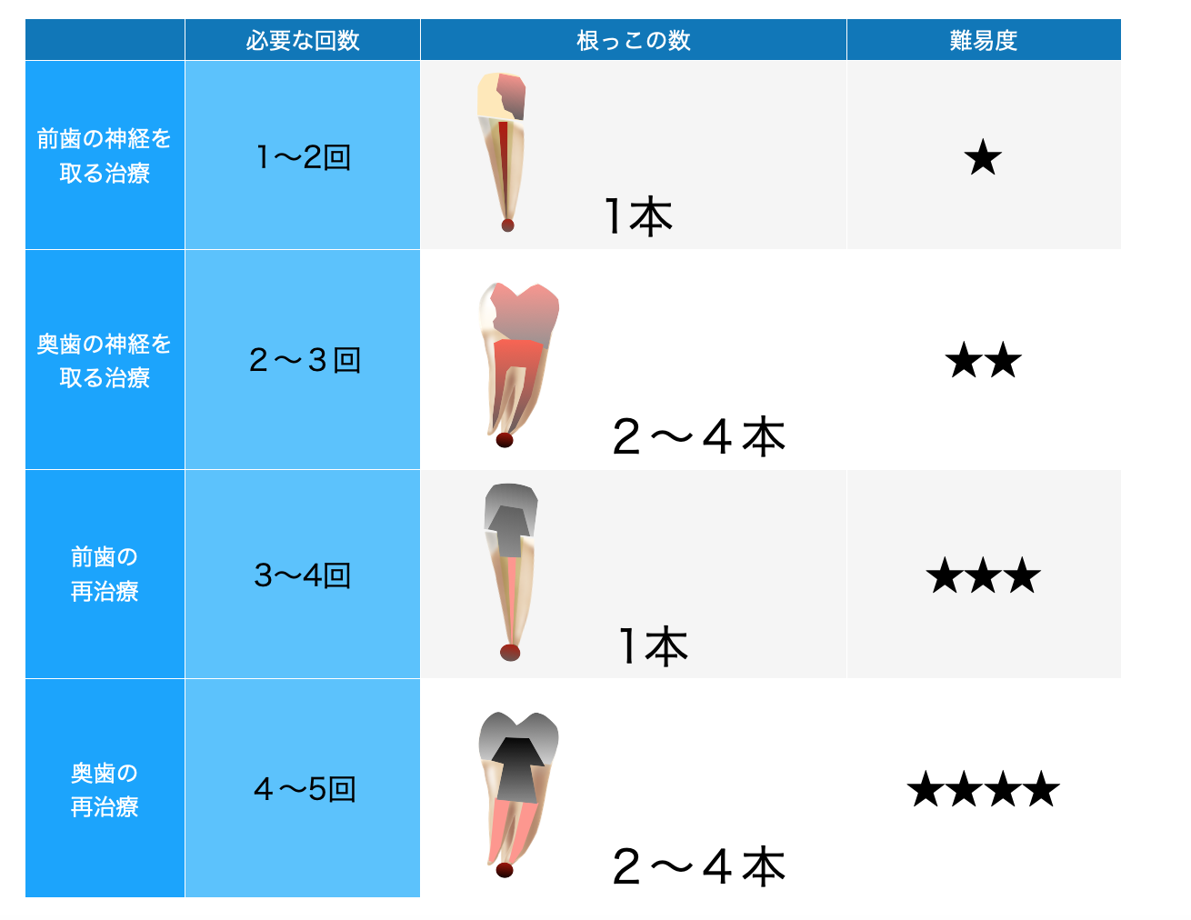 根管治療の根治に必要な回数 期間と長期化させないためのポイント