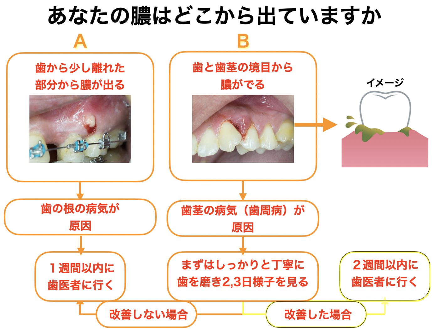 歯茎から膿