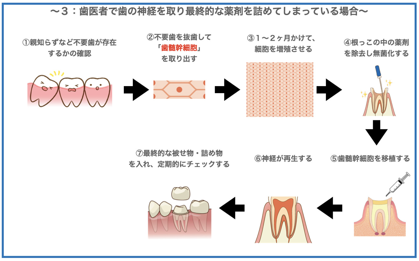 歯髄再生治療